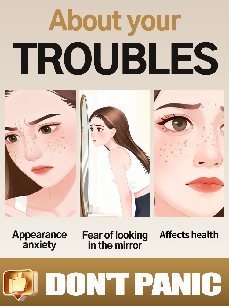 Lightening Facial Freckles Mel - Ultra Luxury Skincare 评论和价格
