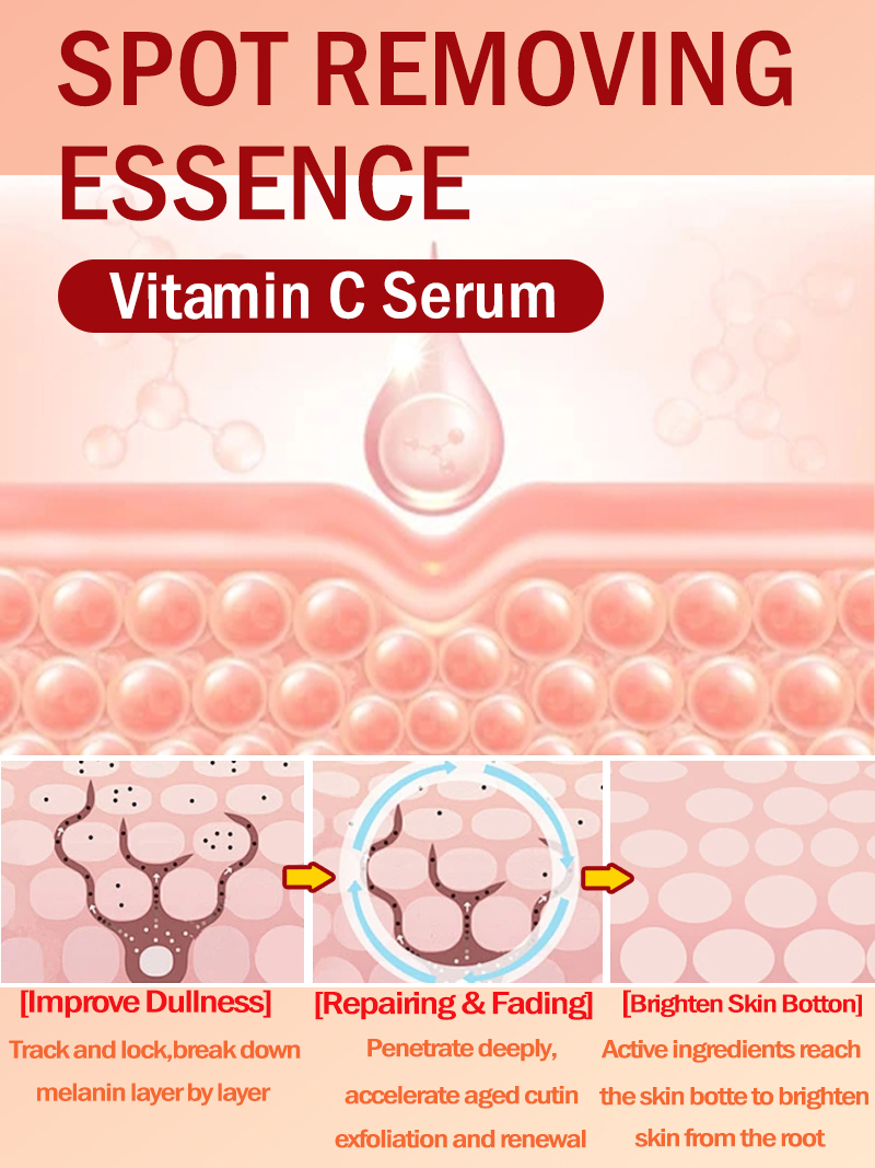 Lighten Freckles Melasma, Faci - Ultra Luxury Skincare 评论和价格